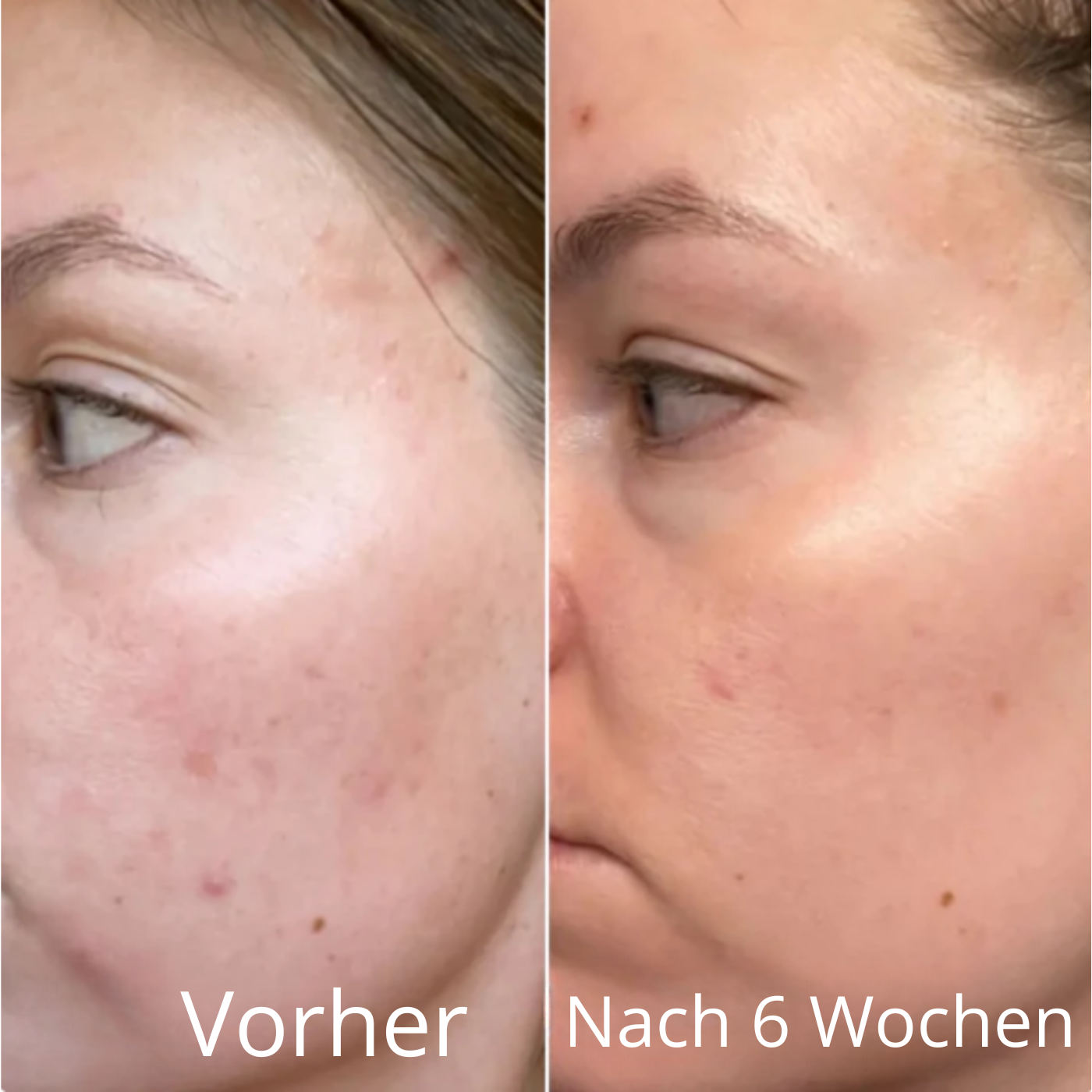 PDRN Peptide Pink Serum