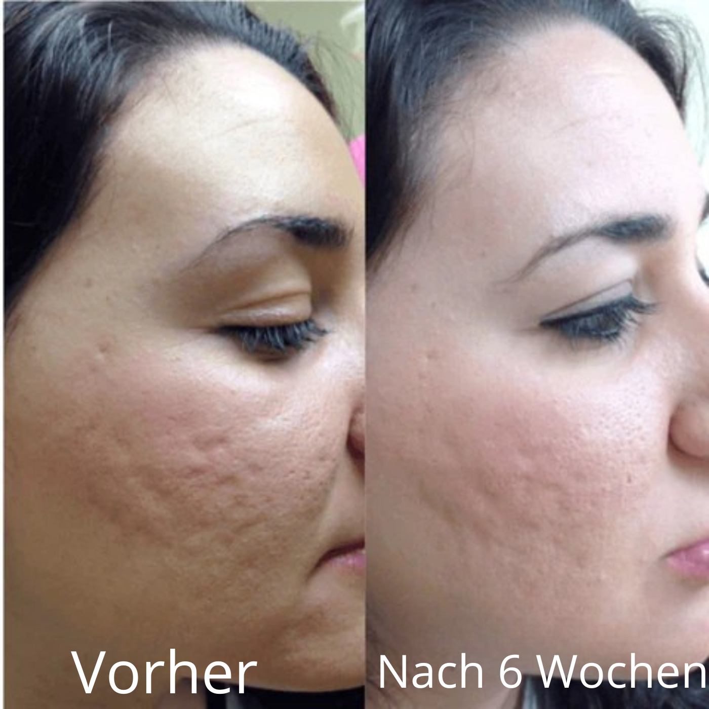 PDRN Peptide Pink Serum