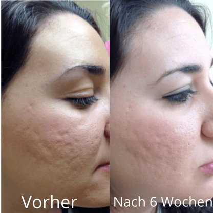 PDRN Peptide Pink Serum